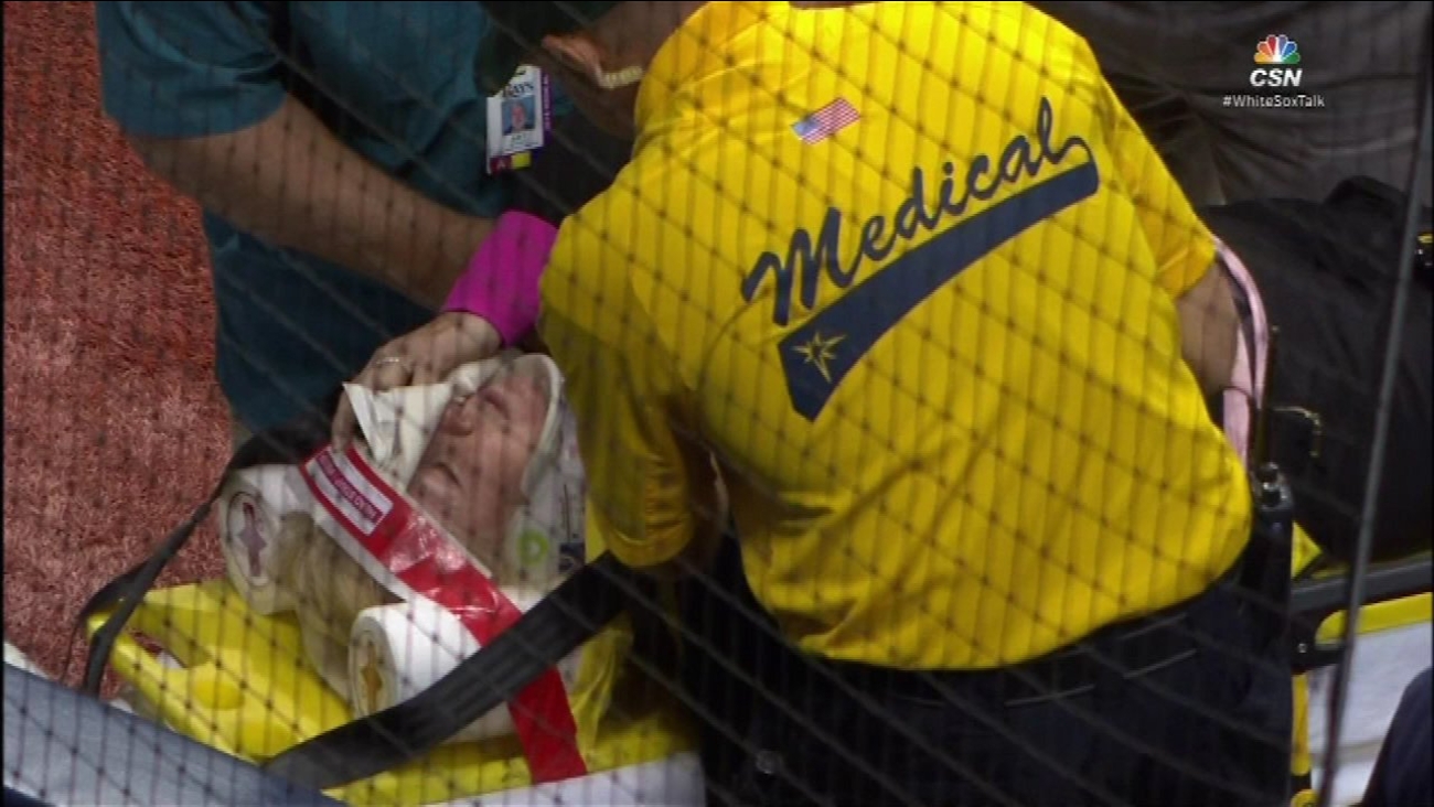 Fan hit by foul ball at Sox game in Tampa ABC7 Chicago